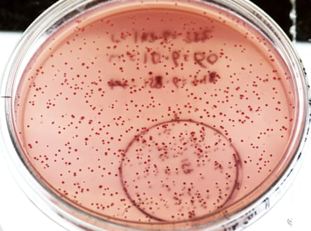 Células rosadas contenidas en una placa de Petri, parte de las cuales está anillada y etiquetada 